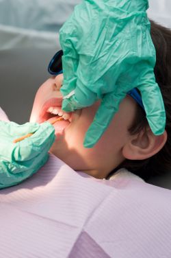 Child gets fluoride varnish applied to teeth