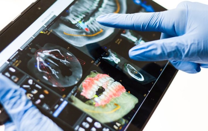 Teledentistry Helps Provide the Right Care at the Right Time
