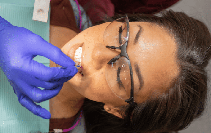 Fluoride varnish