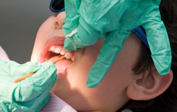 Child getting fluoride varnish applied to teeth