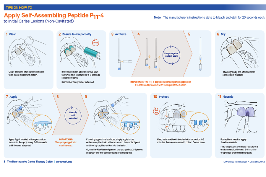 Internal page from Non-Invasive Caries Therapy Guide showing how to apply Self Assembling Peptide P11-4